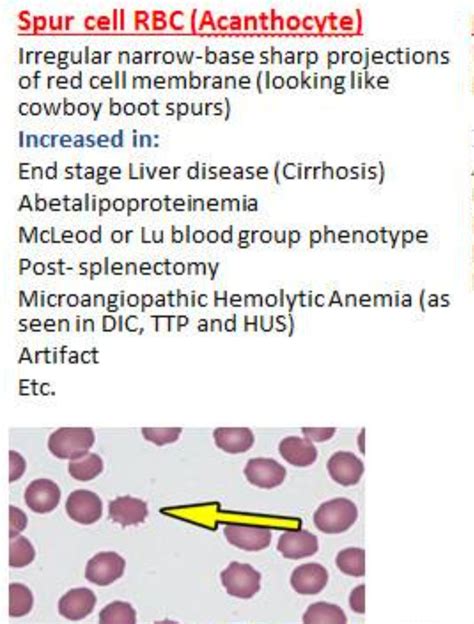 Spur Cells