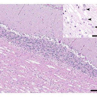 Brain From Index Case Note Marked Vacuolation Of Cerebellar White