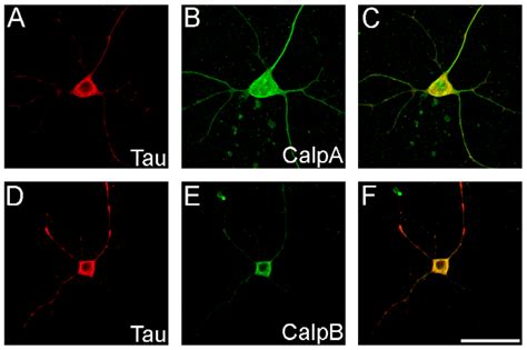 Colocalization Of Tau And Calpain In Drosophila Neurons Neuronal Cells