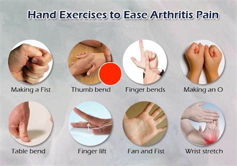 Arthritis Hands Pain