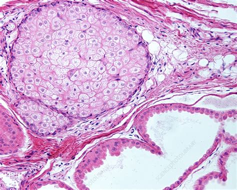 Sudoriferous Glands Histology