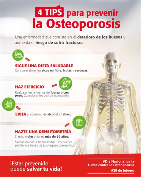 Nota Osteoporosis The Best Porn Website