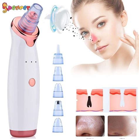 Spencer Electric Blackhead Remover Pore Vacuum Suction Rechargeable