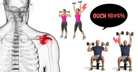 5 Things To Know About Your Shoulder Pain And The Exercises To Fix Them | Dr. Alex Ritza ...