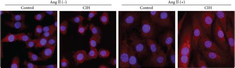 Cih Upregulates Mmp Expression And Mtros Generation In Vitro The