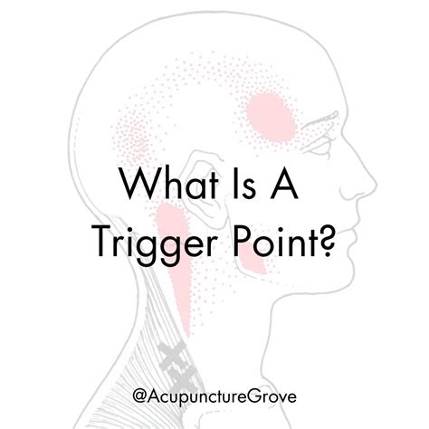 trigger point acupuncture grove