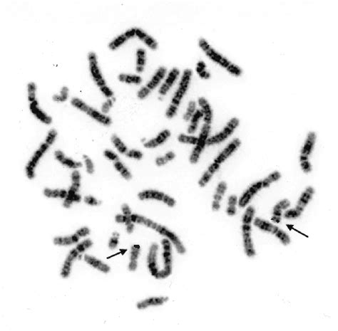 Chromosomal Localization Of The Human S P Gene To Q By Fluorescence