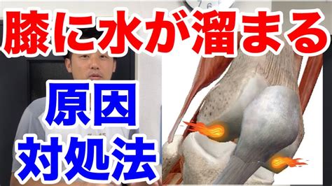 膝に水が溜まる原因と対処法【尼崎市 膝痛】 Youtube