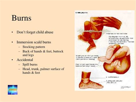 Ppt Wound Management Powerpoint Presentation Free Download Id3530101