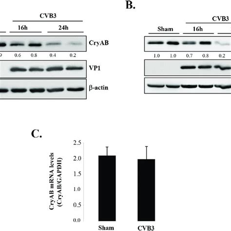 Cvb Infection Leads To Downregulation Of Cryab Hl Murine