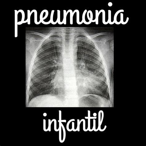 Pneumonia Infantil