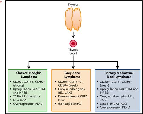 Pdf How I Treat Primary Mediastinal B Cell Lymphoma Semantic Scholar