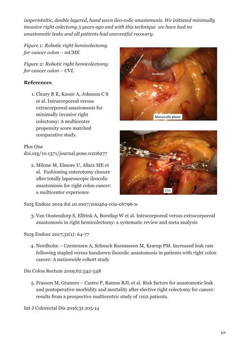 Ppt Tips Amp Tricks For Safe Anastomosis In Minimally Invasive