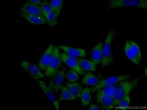 Kras A Specific Mouse Monoclonal Antibody United Bio Research