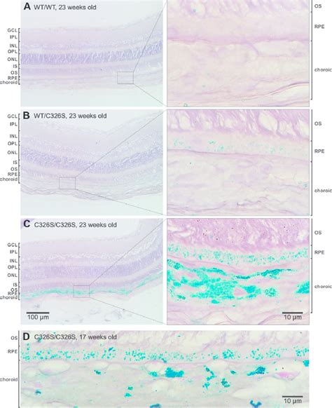 Perls Prussian Blue Stain Of Wt And Fpn C326s Mutant Retinas Perls Download Scientific Diagram