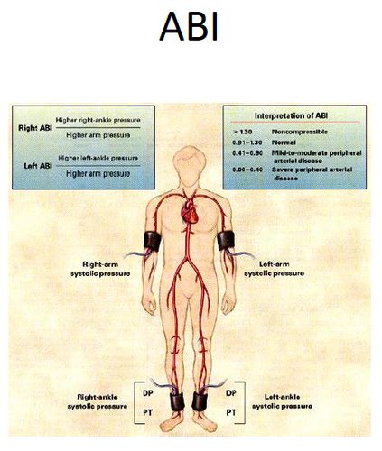 Venous And Arterial Ulcers Patho Exam 2 Flashcards Quizlet