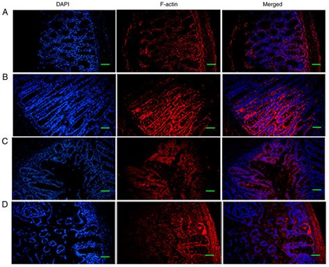 Representative F Actin Immunofluorescence Staining Images Of Colonic