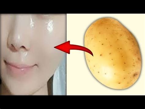 Skin Whiting Potato Face Mask To Get Super Bright Skin INSTANTLY