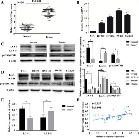 Malat1 Is Remarkably Overexpressed In Crc And Associates With