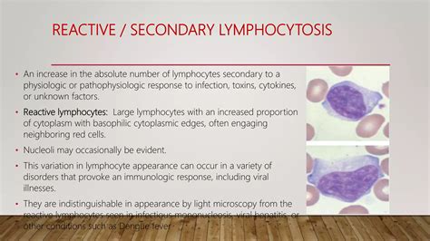 Approach To A Case Of Lymphocytosis Ppt