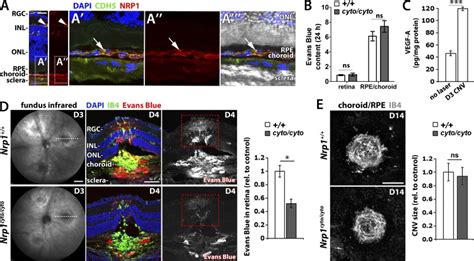 Vegf165 Induced Vascular Permeability Requires Nrp1 For Abl Mediated