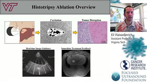 Cancer Immunotherapy Workshop Overview Of Different Focused