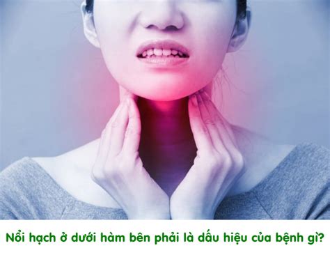 noi hach  duoi ham ben phai la trieu chung cua benh gi