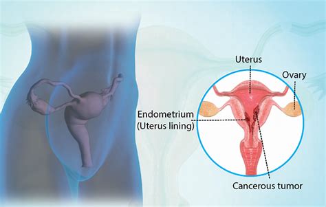 Health Condition Symptoms Causes Treatment And More