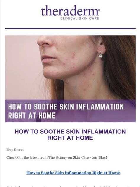 Therapon Skin Health Want To Sooth Your Skin Inflammation More From