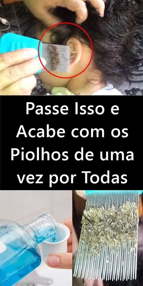 Comprimido Para Acabar Com Piolho - Melhor Po Para Piolhos – Remédio para piolho comprimido infantil: qual ...