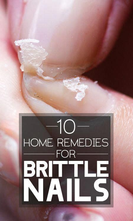 25 Easy And Natural Nail Care Tips And Tricks To Try At Home Brittle