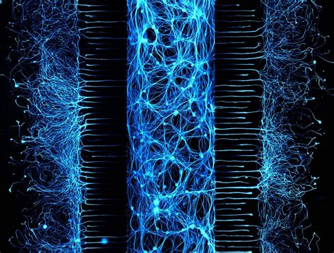 Visualizing Axon Pruning | TS Digest | The Scientist