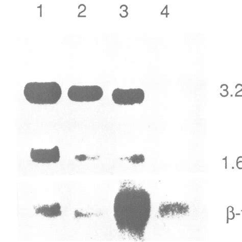 Northern Blot Hybridization Analysis A Lane 1 30 Jig Of Total RNA