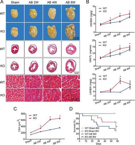 Osmr Deficiency Aggravates Pressure Overload Induced Cardiac