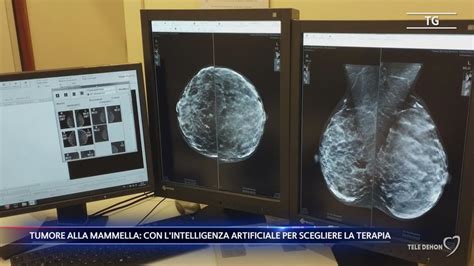 Tumore Alla Mammella Con L Intelligenza Artificiale Per Scegliere La