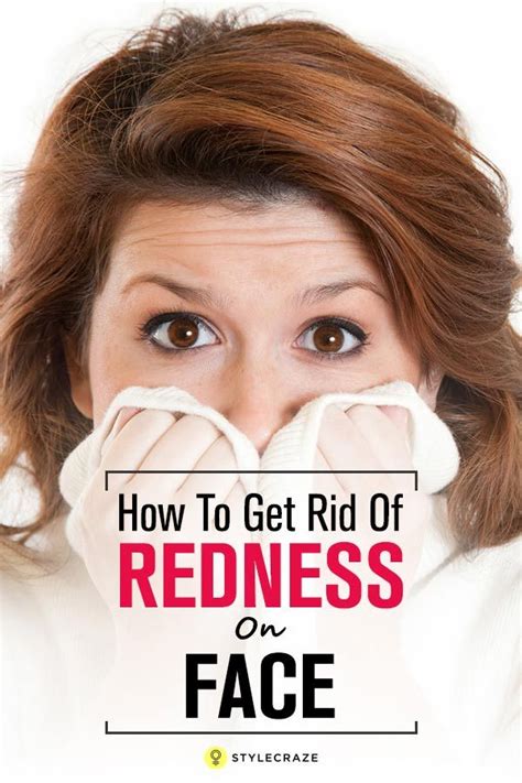 Home Remedies To Reduce Redness On The Face Artofit