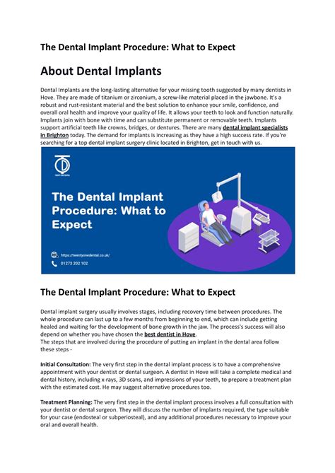 Ppt The Dental Implant Procedure What To Expect About Dental