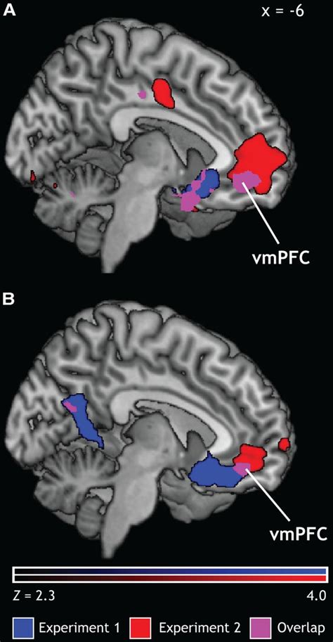 Ventromedial Prefrontal Cortex And Orbitofrontal Cortex