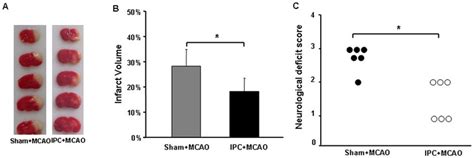 Ischemic Preconditioning Ipc Attenuates Brain Damage Caused By Middle