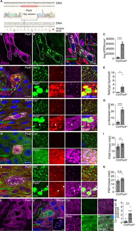 Pink Keap And Rtnl Regulate Selective Clearance Of Endoplasmic