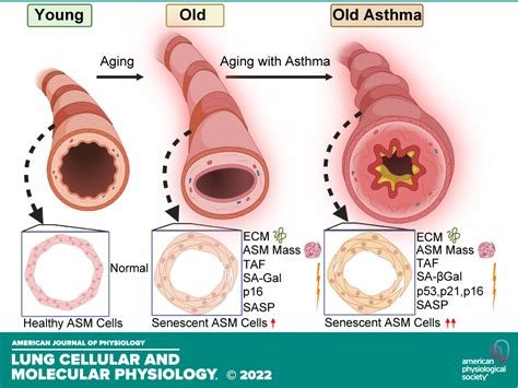 Cellular Senescence Is Increased In Airway Smooth Muscle Cells Of