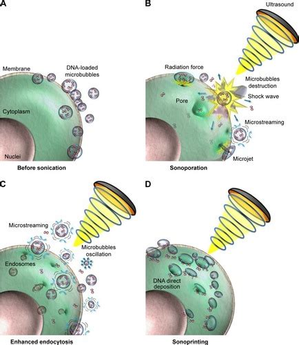 Full Article Ultrasound Mediated Microbubble Destruction A New Method