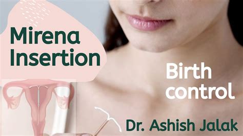 MIRENA INSERTION PROCEDURE STEPS │IUD BIRTH CONTROL│IN MARATHI BY DR ...