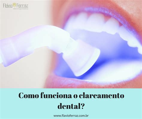 Como funciona o Clareamento Dental Dr Flávio Ferraz