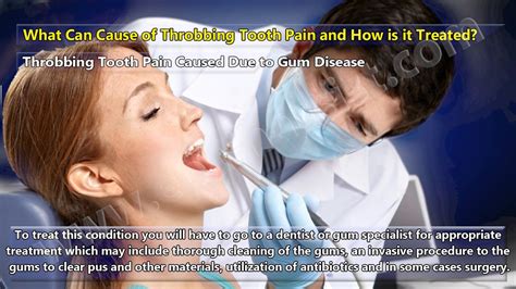 Causes Of Throbbing Tooth Pain And It S Treatment YouTube