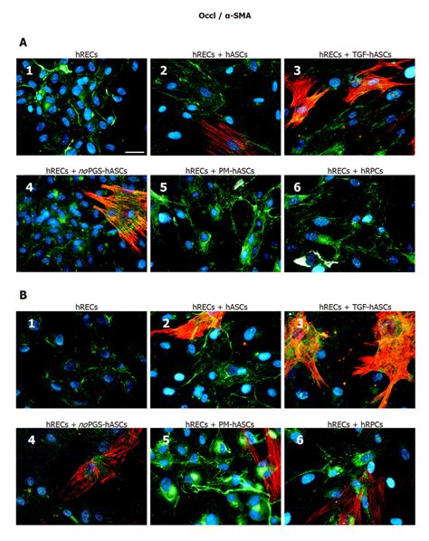 Double Labeling Experiments Of Occludin Green Immunofluorescence And