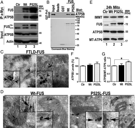 Fus Interacts With Atp5b And Colocalizes With Atp5b In Mitochondria