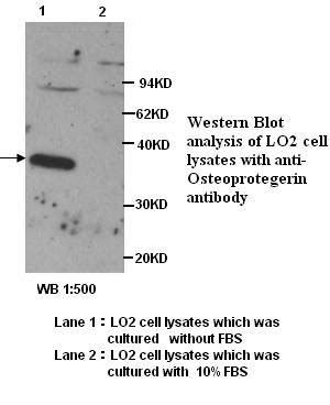 IHC Plus OPG Osteoprotegerin Polyclonal Antibody Rabbit LSBio