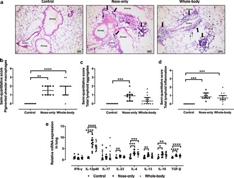 Histological Evaluation Of Lung Inflammation A Hande Staining Of Lung Download Scientific