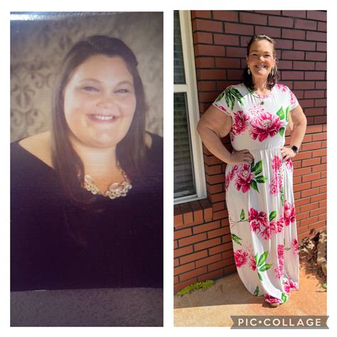 F3258” 420215205 3 Years Got The Gastric Sleeve Done In June 2021 I Feel So Much